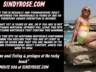 New anal fisting & prolapse convenient burnish apply rocky lakeshore Sindy Nick scrimp